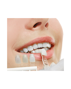 Dental Veneers