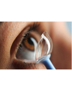 Scleral Lenses