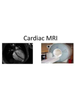 Cardiac MRI