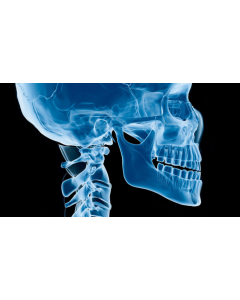Orthognathic Surgery