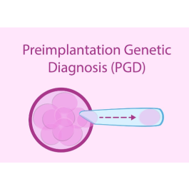 Preimplantation Genetic Diagnosis